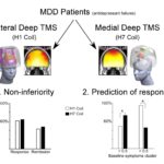 <b>Pursuing personalized medicine for depression by targeting lateral or medial prefrontal cortex with ...</b>